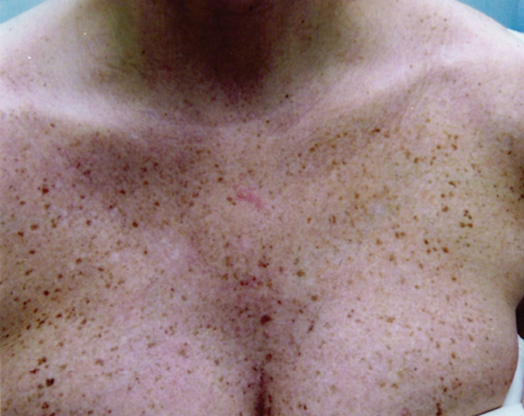 Before